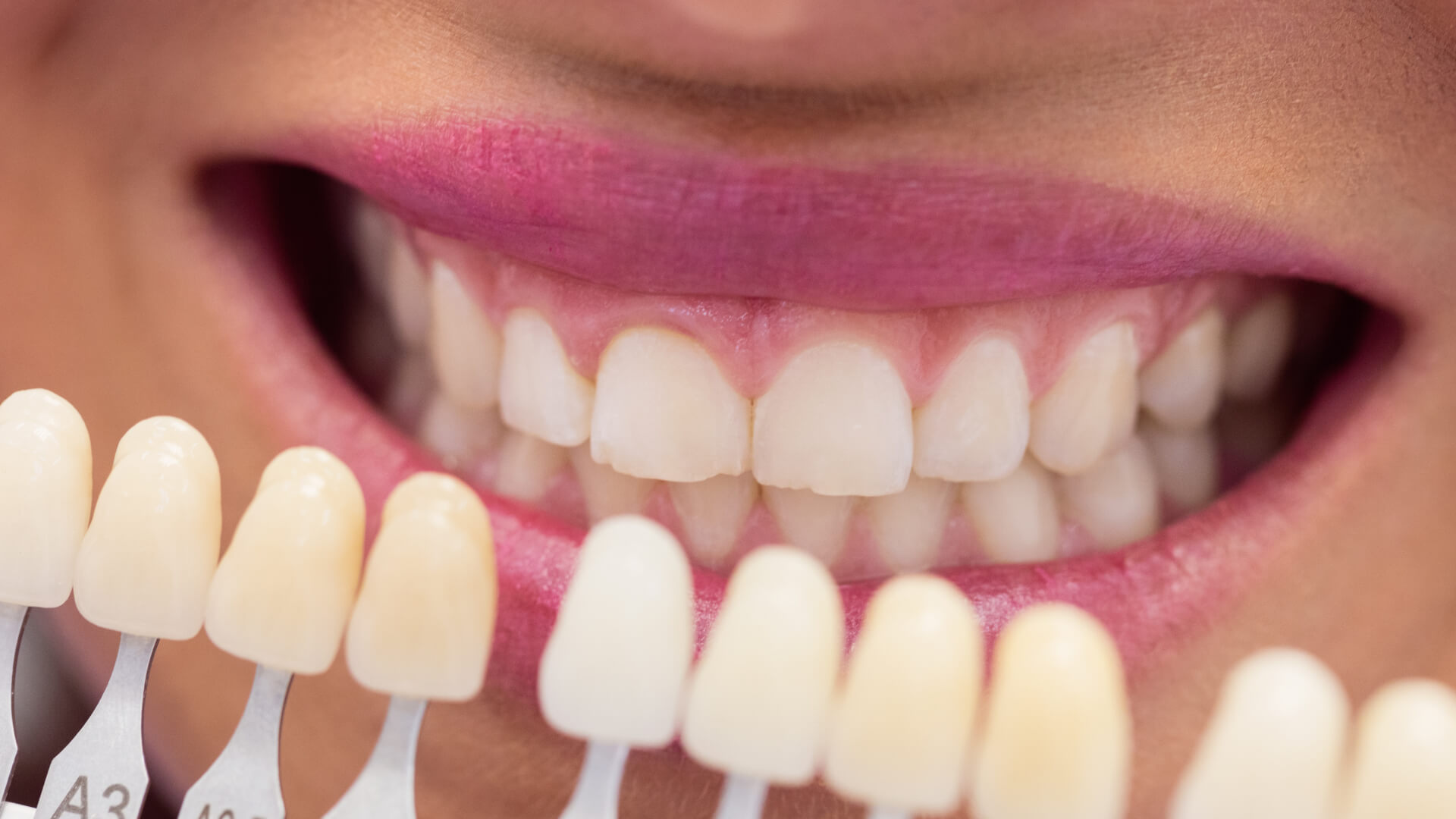 teeth-03