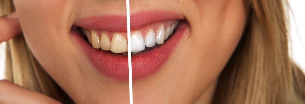 teeth-2414909
