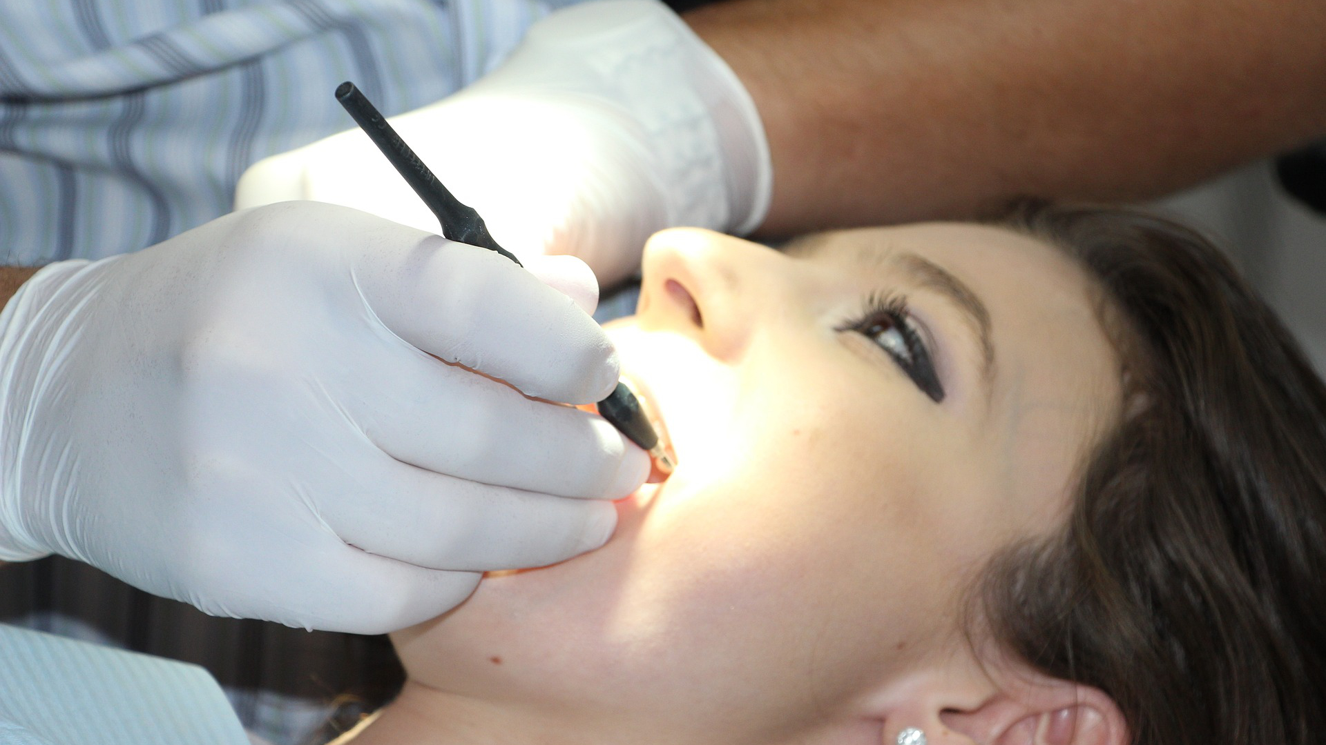 teeth-cleaning-01